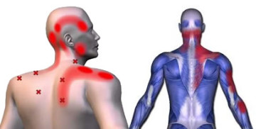 Jaw Neck and Shoulder Pain San Diego – Coronado – San Diego Global ...